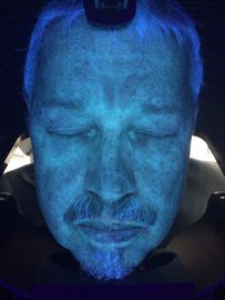De Diagnosemachine van de huidscanner, 3d Uvhuidanalyse