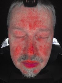 De gezichtsanalyse van de Huidscanner, de Machine van de Huidanalysator met Ce-Certificaat