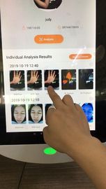 Van Korea de Gezichts Digitale 64gb Opslag van het de Analysesysteem voor Artsenkliniek