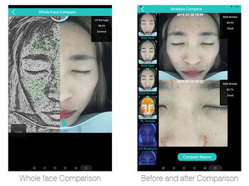 Het intelligente Probleem van Huidanalyzer 12skin dat met Tablet 20 Miljoen Pixel wordt ontdekt