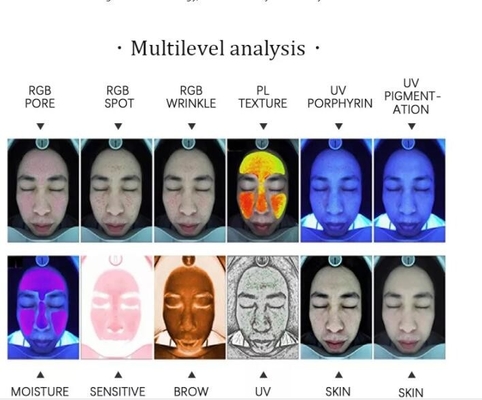 RGB UVpl Android Professionele Huidanalysator 15MP Facial Camera
