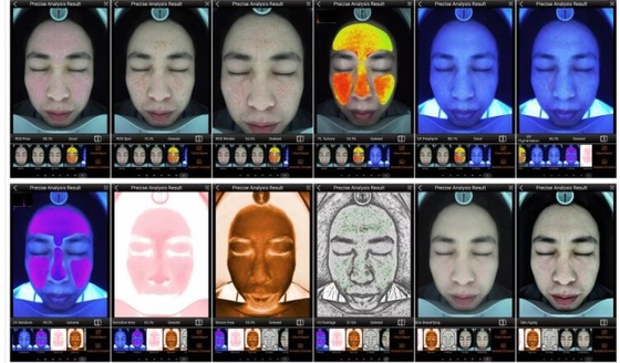 RGB UVpl Slimme Huidanalysator