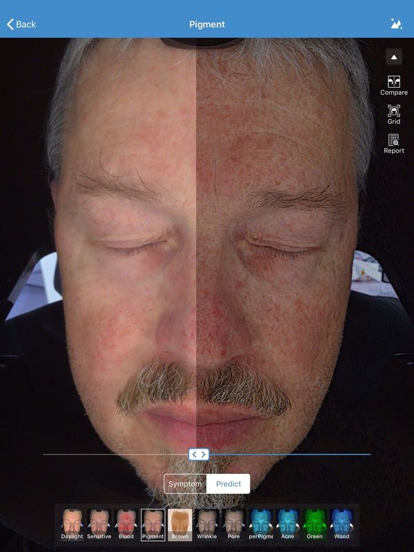 De gezichts 3d Opslag van de Scannervisia 32gb van de Huidanalysator voor de Kliniek van de Artsenhuid